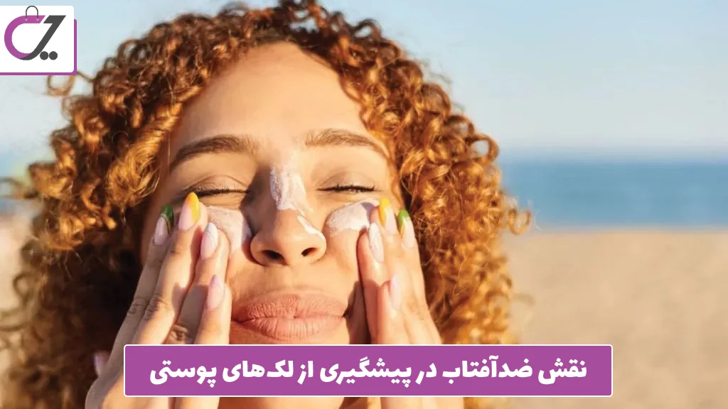 نقش ضدآفتاب در پیشگیری از لک‌های پوستی