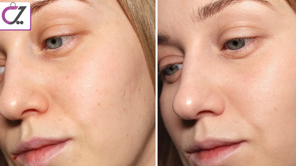 چگونه به صورت صحیح از سی ‌سی کرم فاقد چربی استفاده کنیم؟