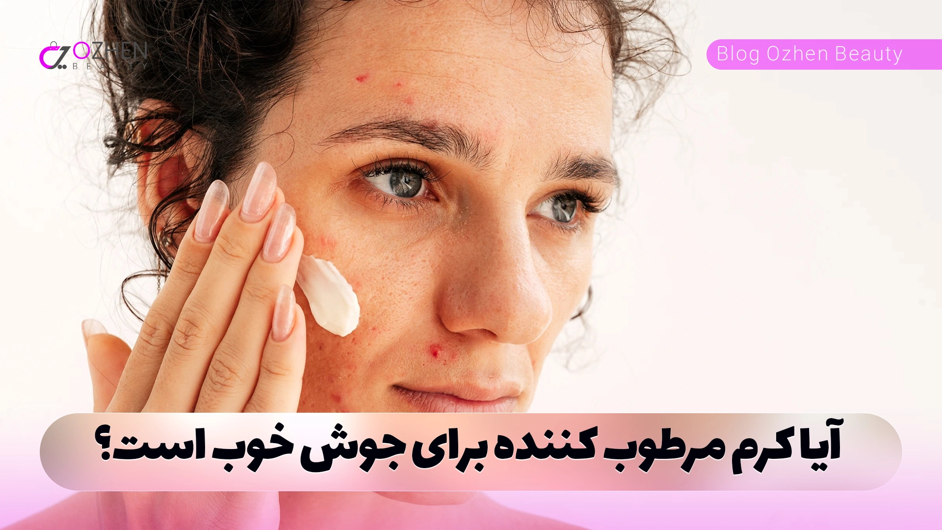 آیا کرم مرطوب کننده برای جوش خوب است؟