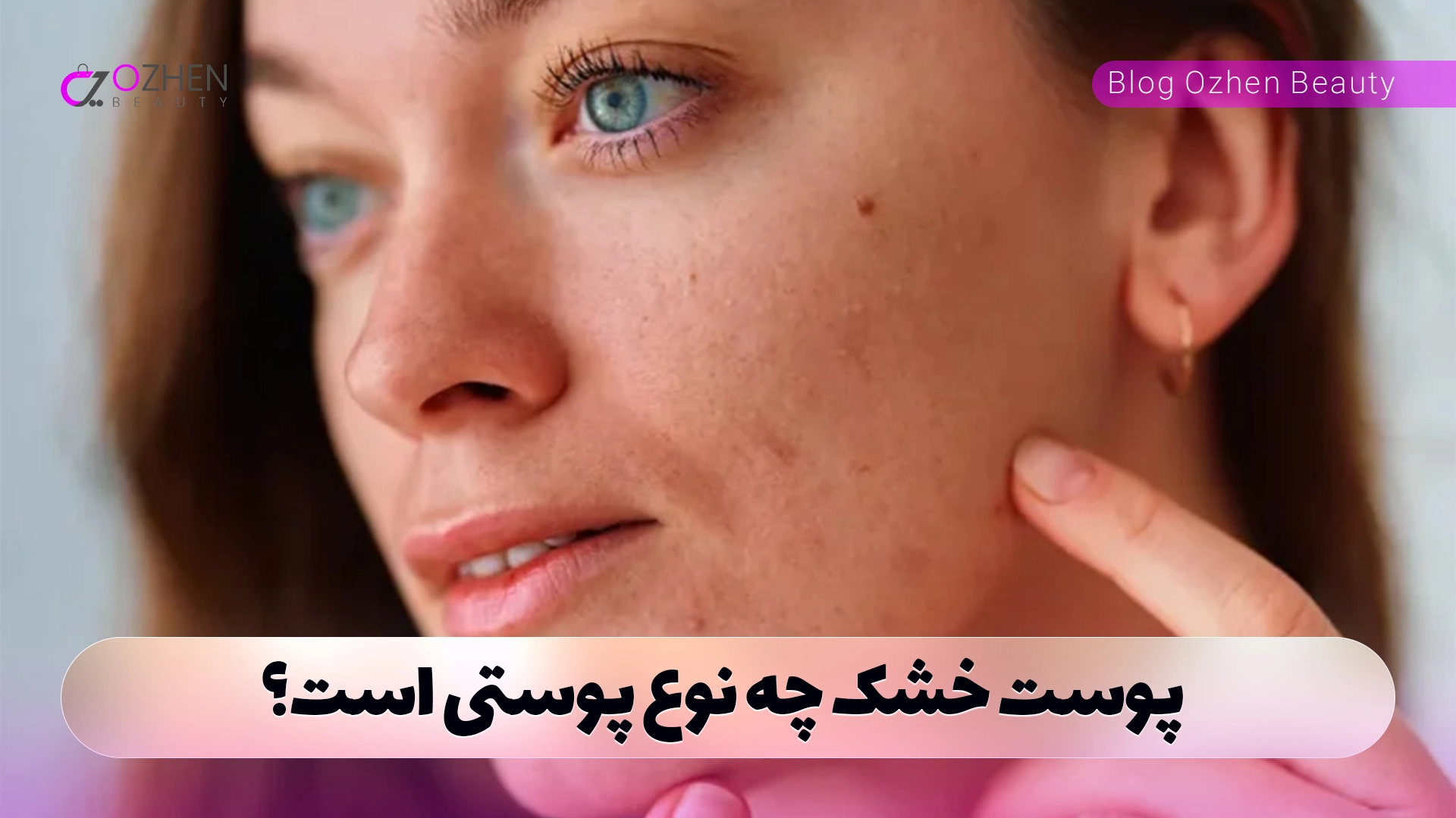 پوست خشک چه نوع پوستی است؟