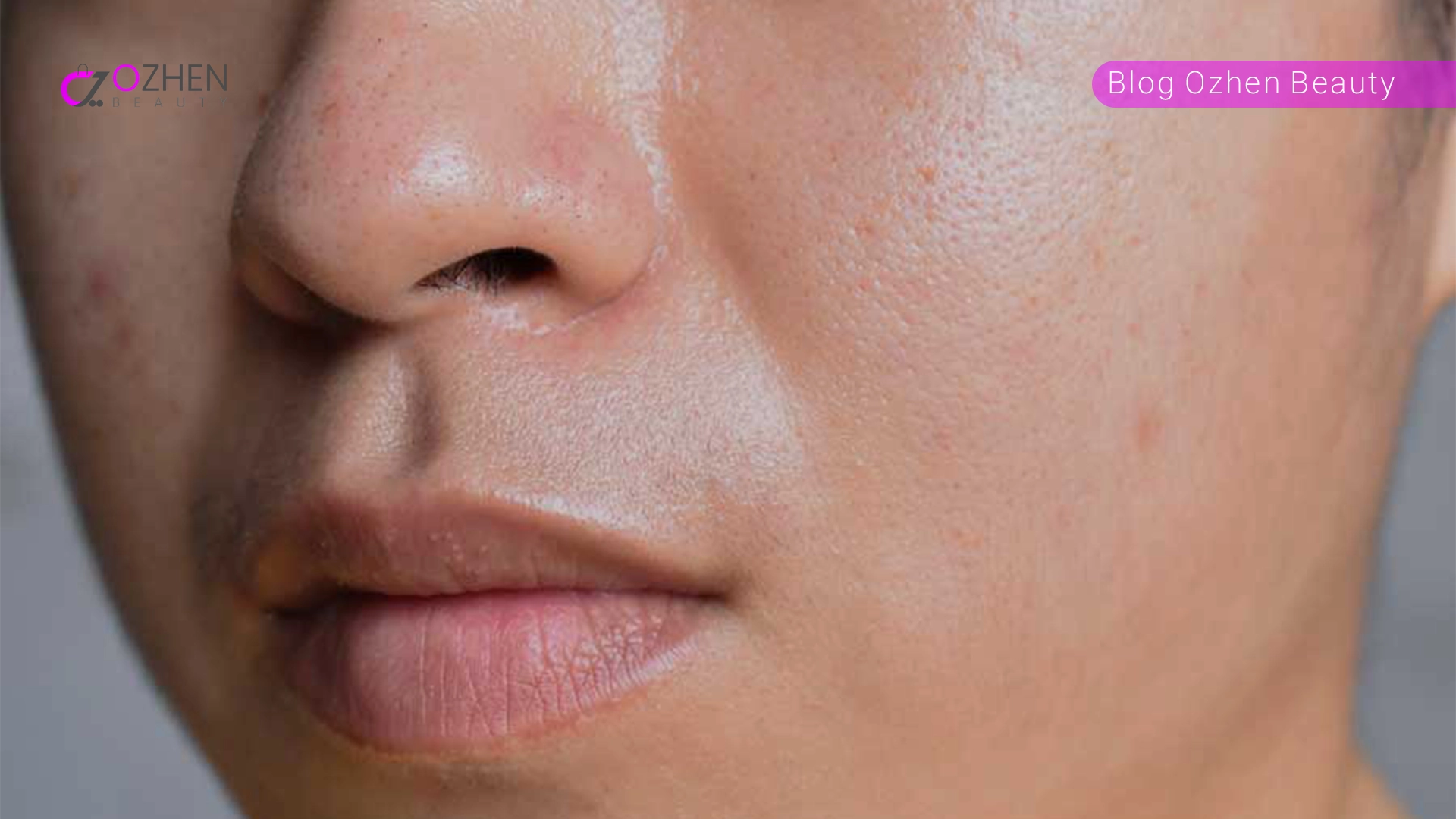 پوست چرب چه نوع پوستی است؟