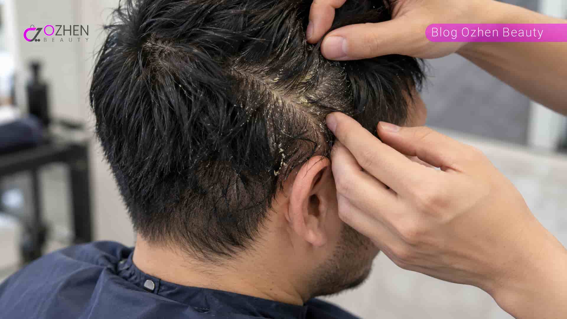 تفاوت شوره خشک و شوره چرب چیست؟