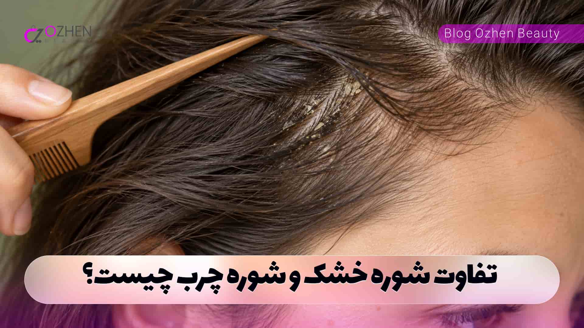 تفاوت شوره خشک و شوره چرب چیست؟