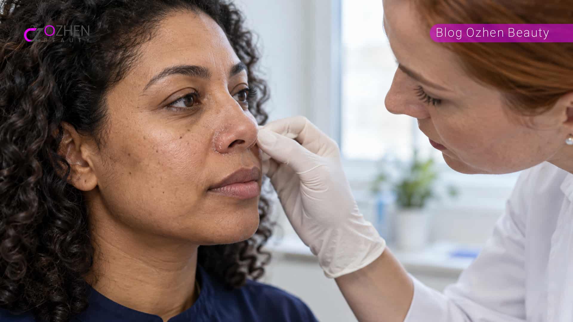چرا اطراف بینی پوسته پوسته میشود؟